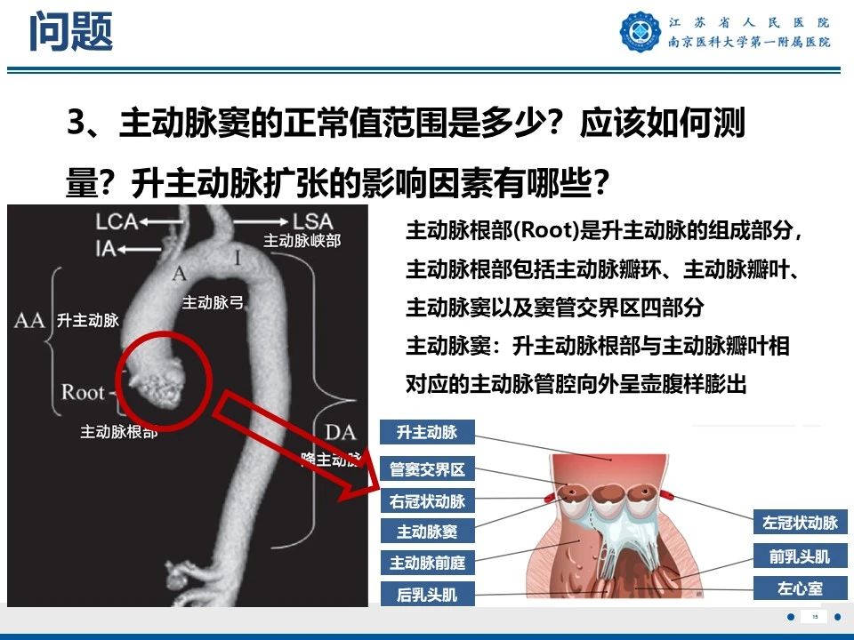 sb54kpvdn2t2504.jpg