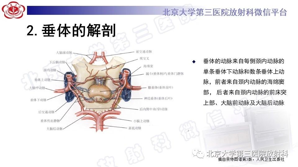 j2cyt2vupd4986.jpg