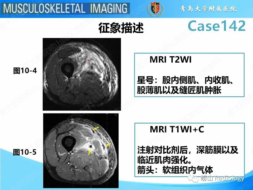 tqpxcukwqi12101.jpg