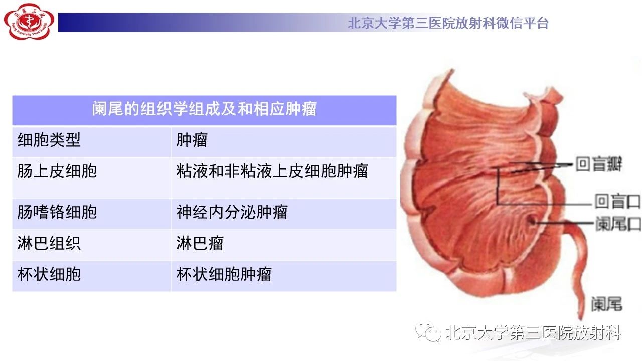 ys1vgpig0hz2561.jpg