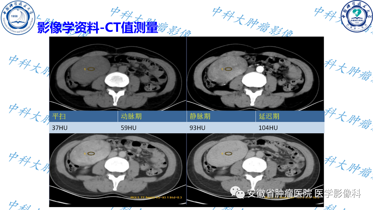 hkgoojicbi22872.png