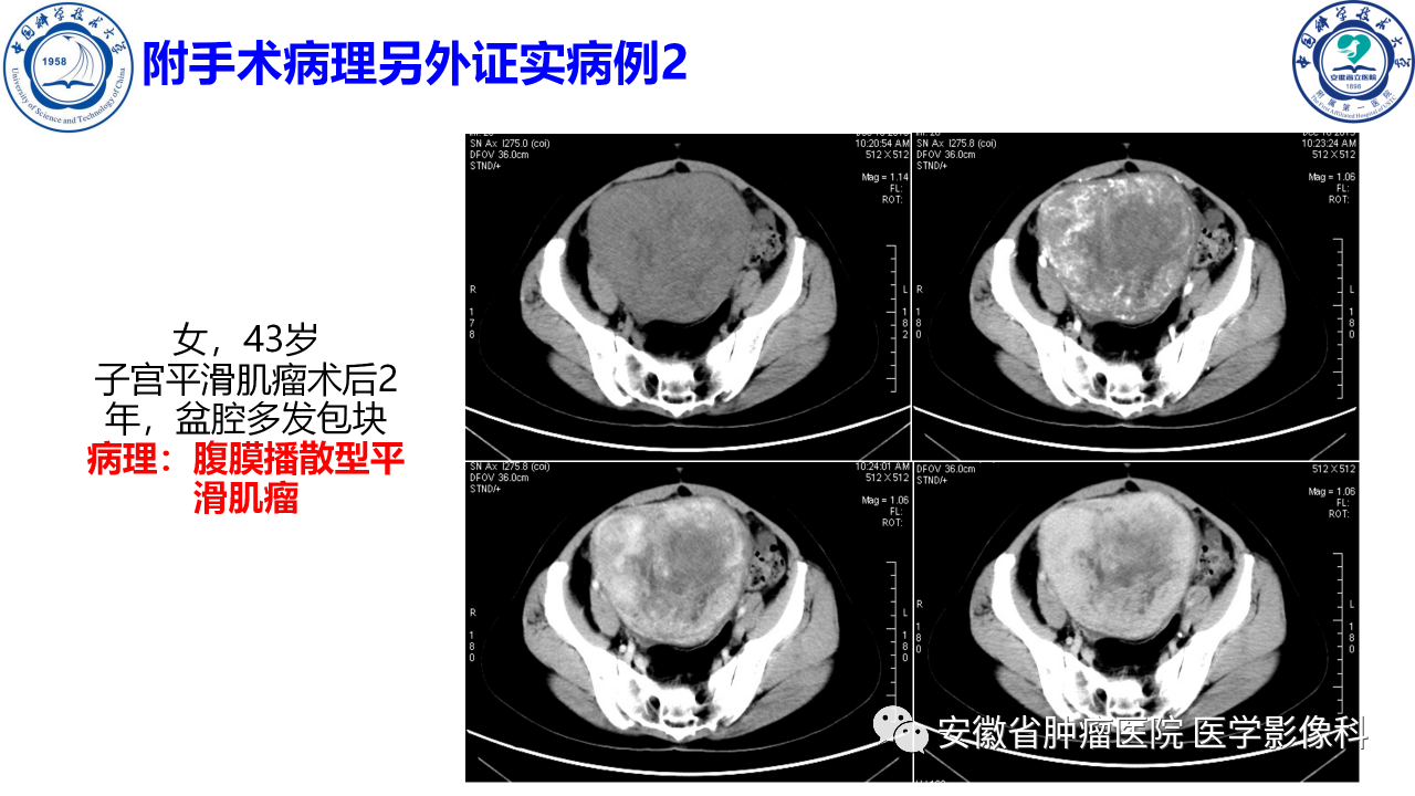 z420wuzmjcm2882.png