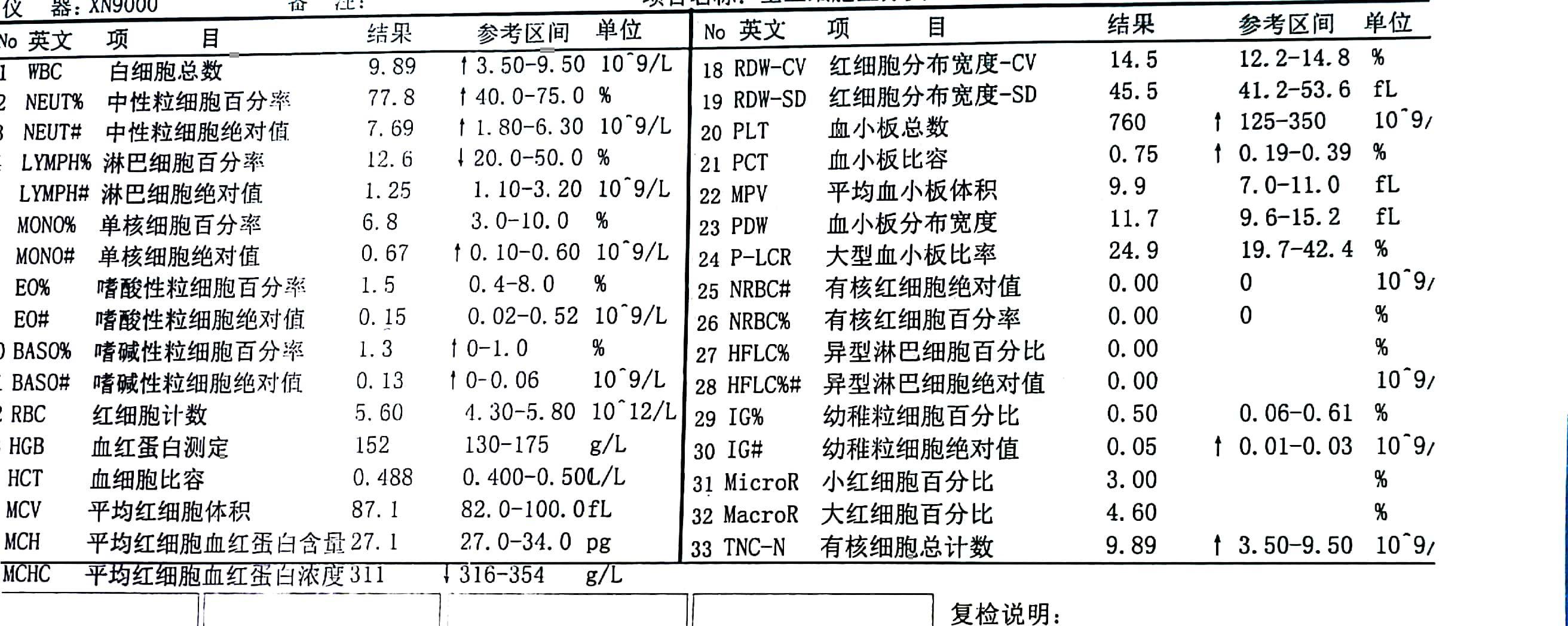 qkwjr35boqm3310.jpg