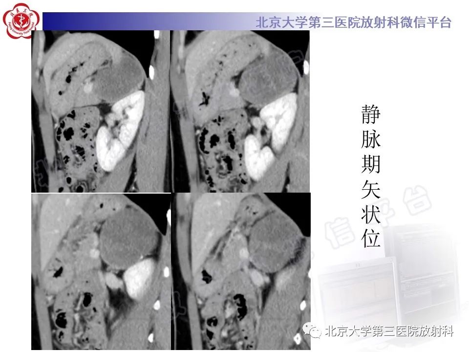 vs1xdtdox5x5540.jpg