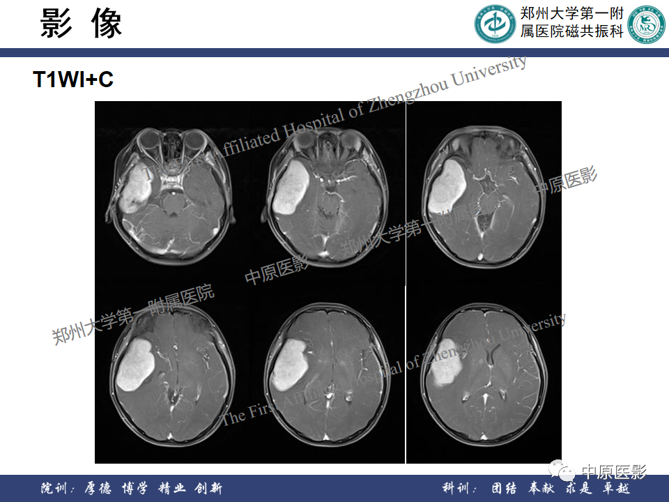 tgpj3et4xcw5841.png