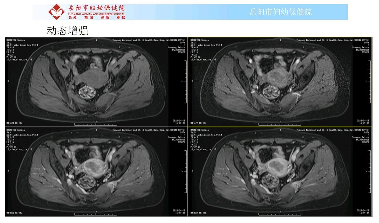 uxce0nn5aqi7191.jpg