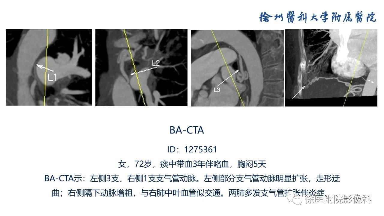 4ks53k13qho7973.jpg