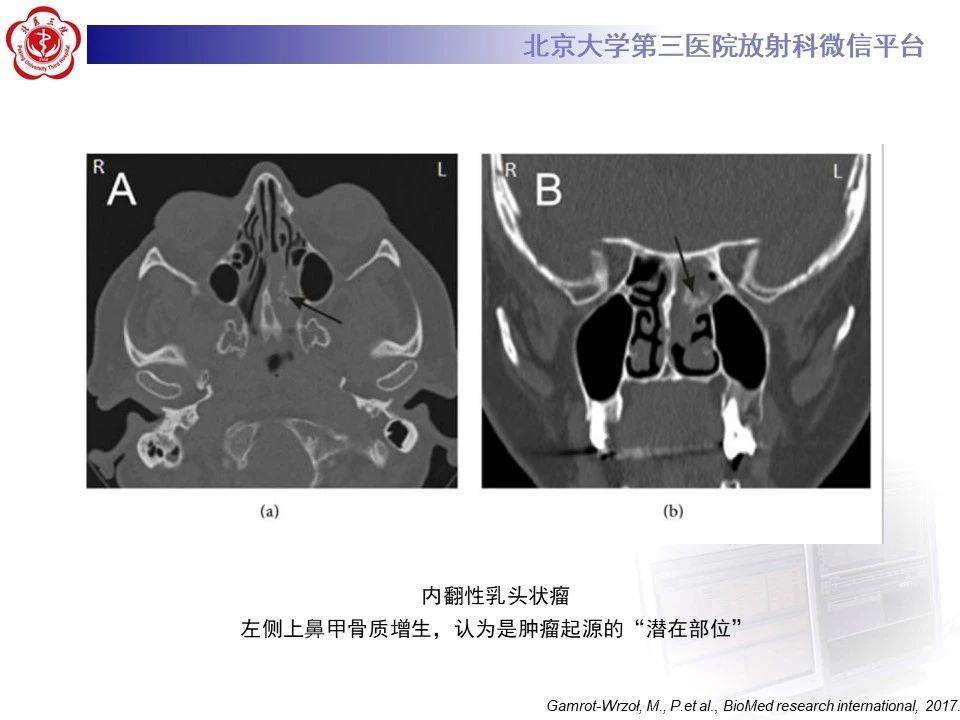 uix4w2smtd38225.jpg