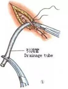 mabwcwk32fu8519.jpg