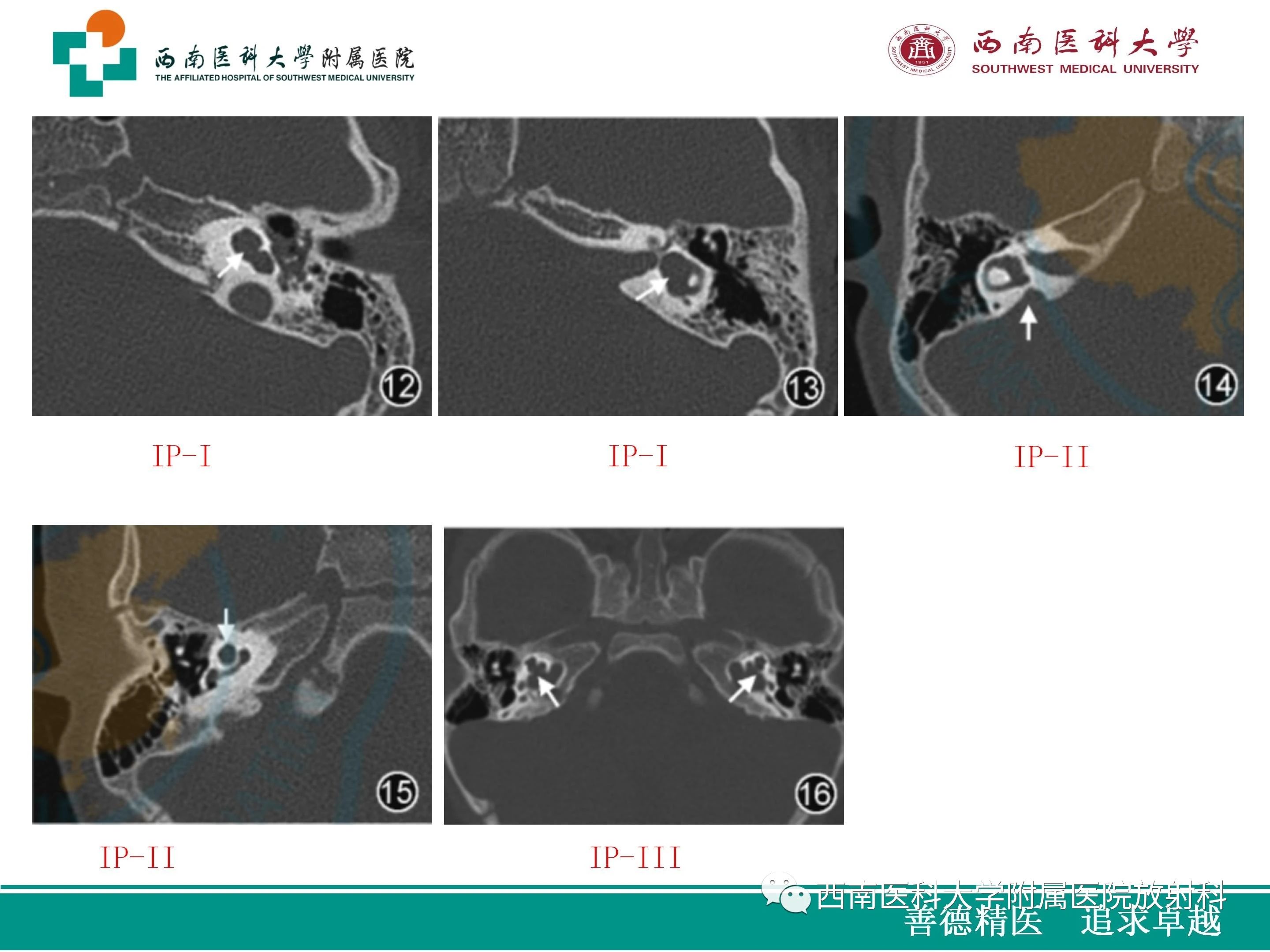 sp1qx3rxewu9055.jpg