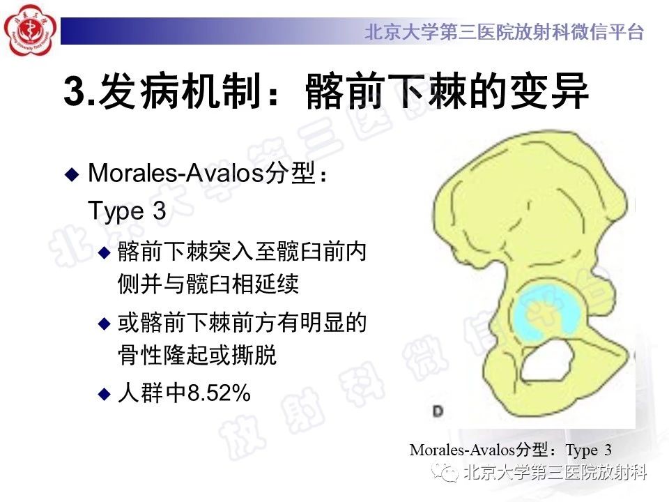 q2btdly3dvo9407.jpg