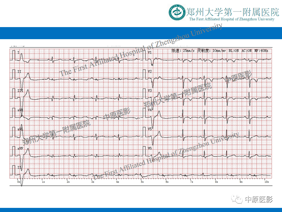 kcebpf0wa319424.jpg