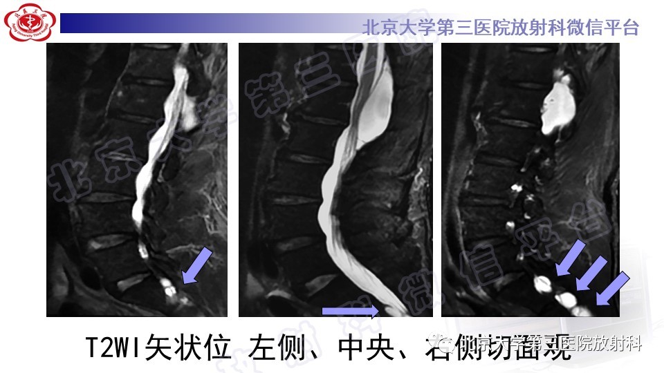 ns2pqjhi14g9681.jpg