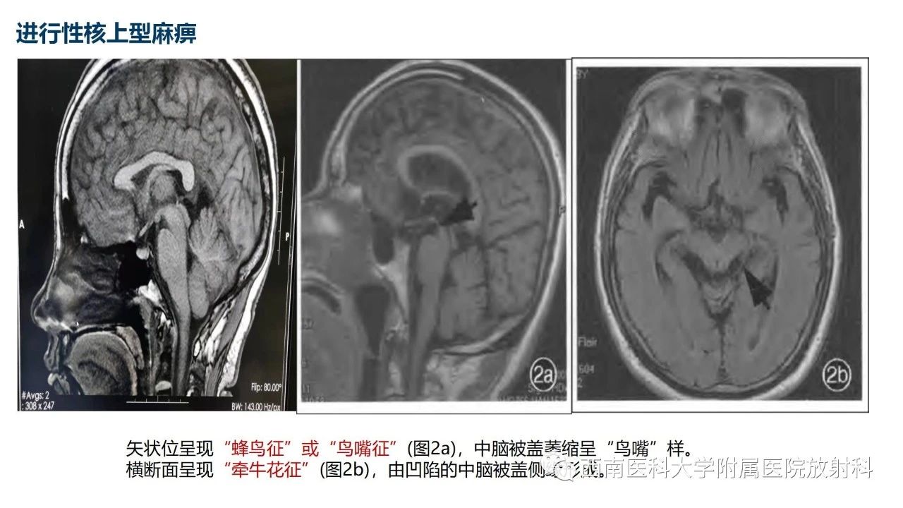 jytqa3as25v9816.jpg