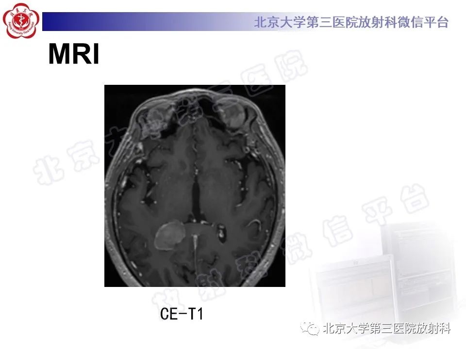 rw3ohlmed4c10630.jpg