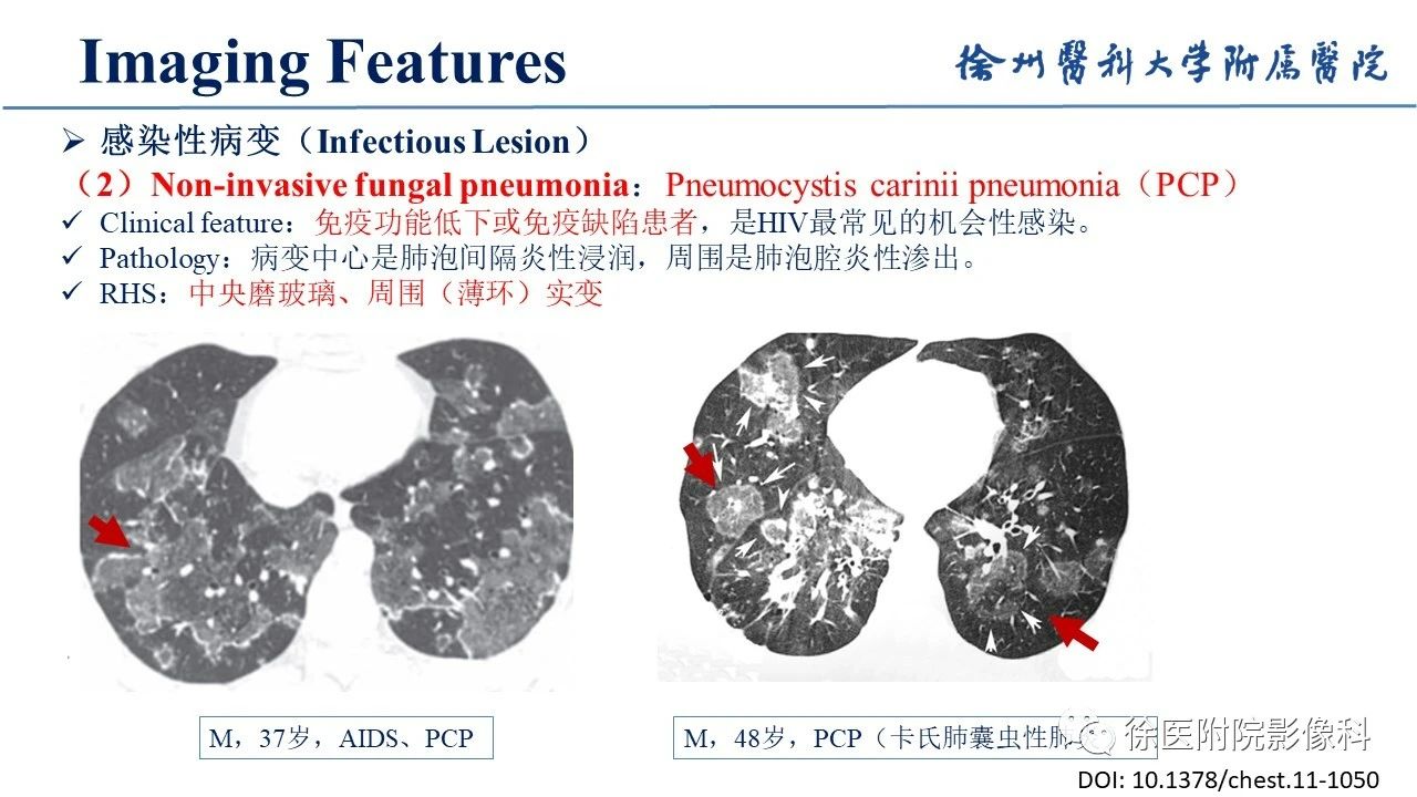 1uacrj2cadq10791.jpg