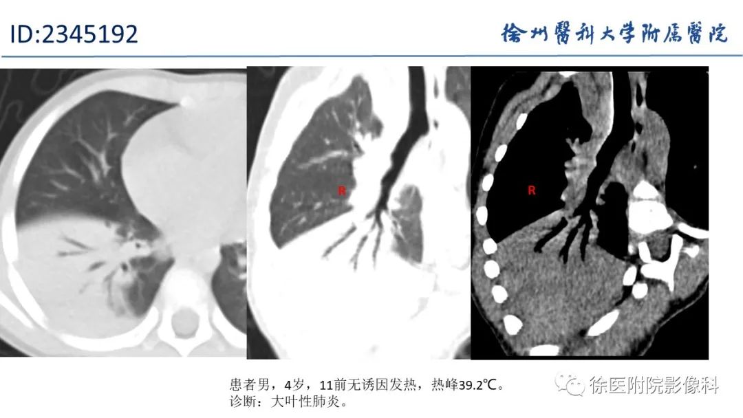 lgftc5qdg3e10993.jpg