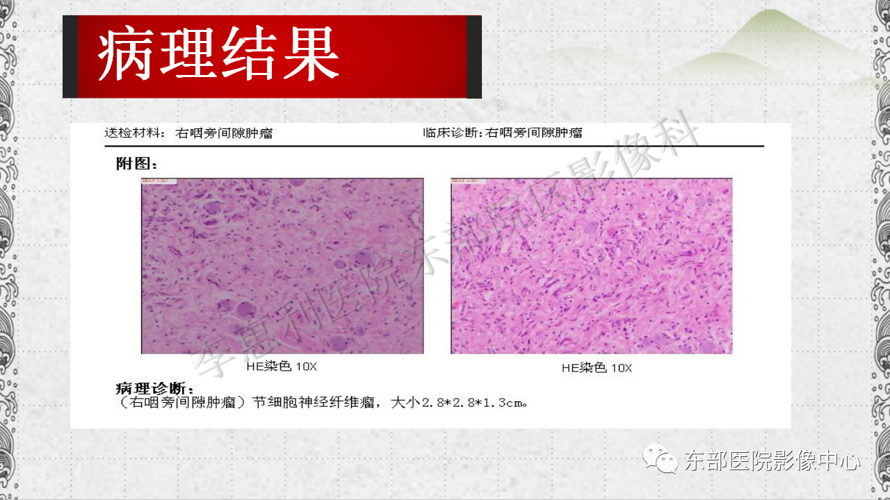 sst2iisd1jk11184.jpg