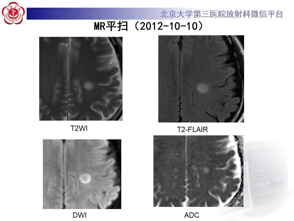 zw5xrbm4gw112406.jpg