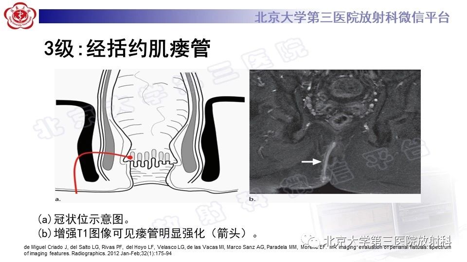 sulpvnow5zv12796.jpg