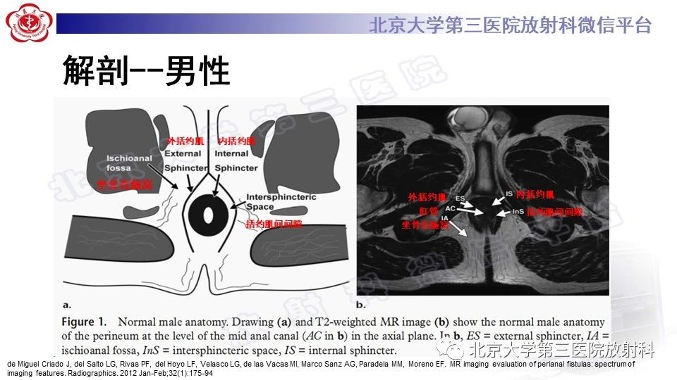 0qzz35sypkd12787.jpg