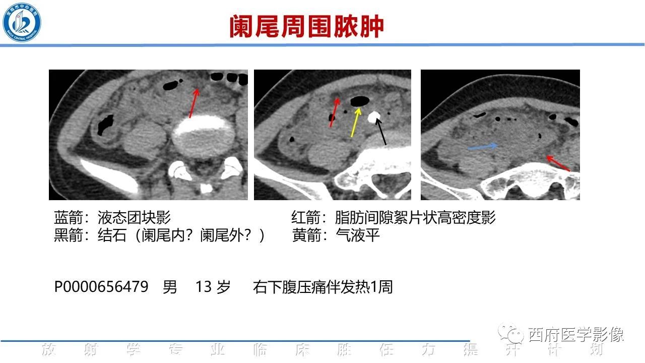 sbwta51l0nt13316.jpg