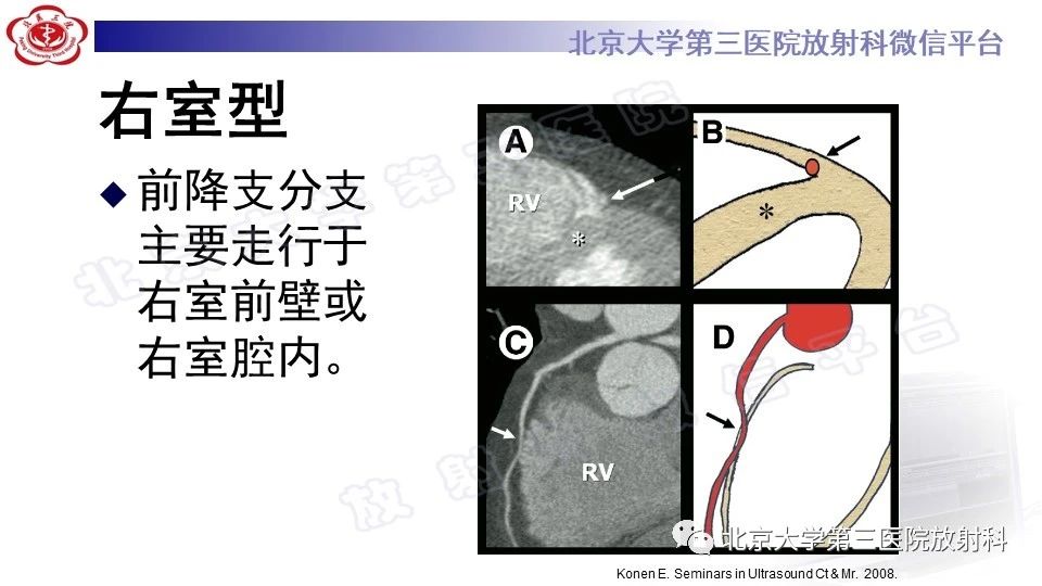 41cjdfnj1mt13415.jpg