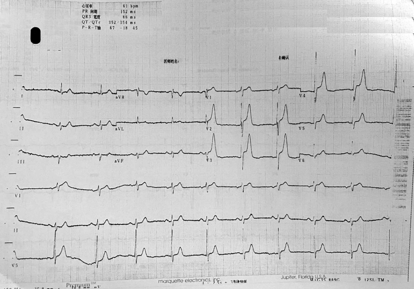 5ljj12zs2yo13468.jpg