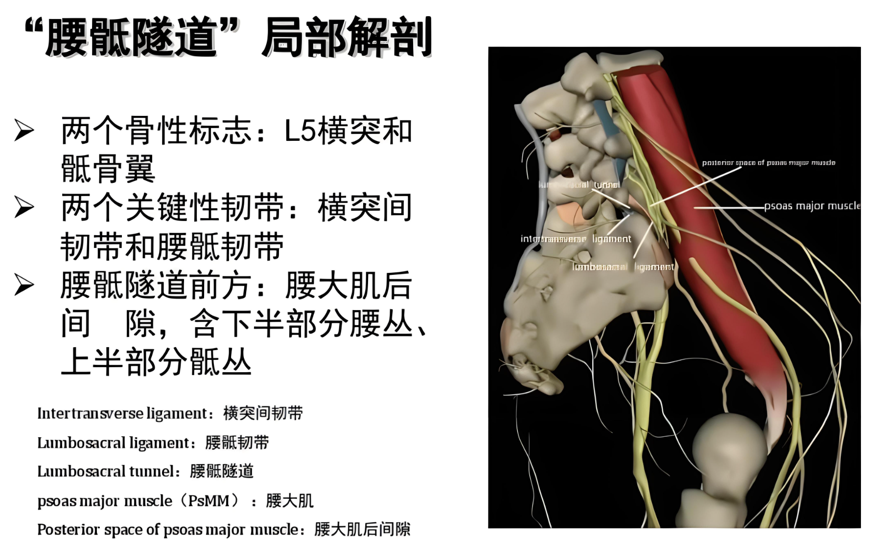 腰骶隧道的局部解剖图