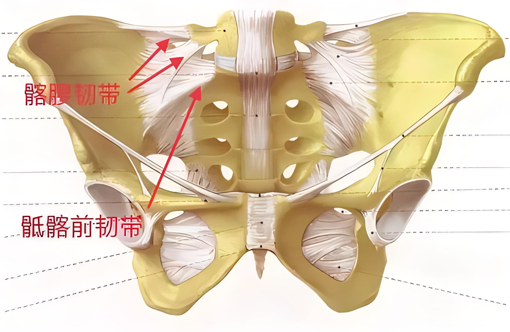 腰骶隧道的局部解剖图