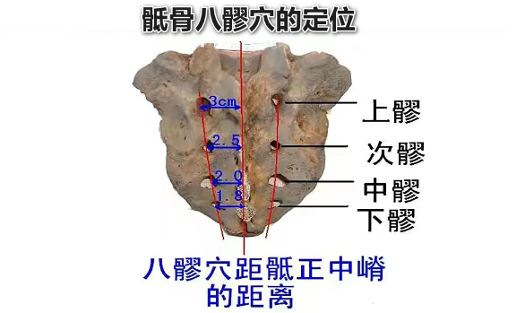 针刀治疗顽固性肛门会阴痛