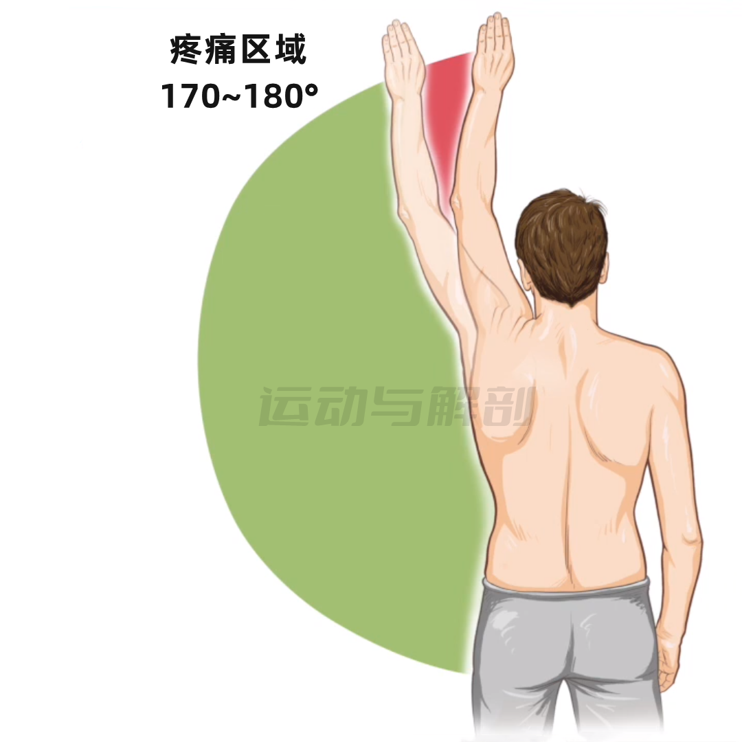 肩部评估干货——抬肩疼痛弧测试