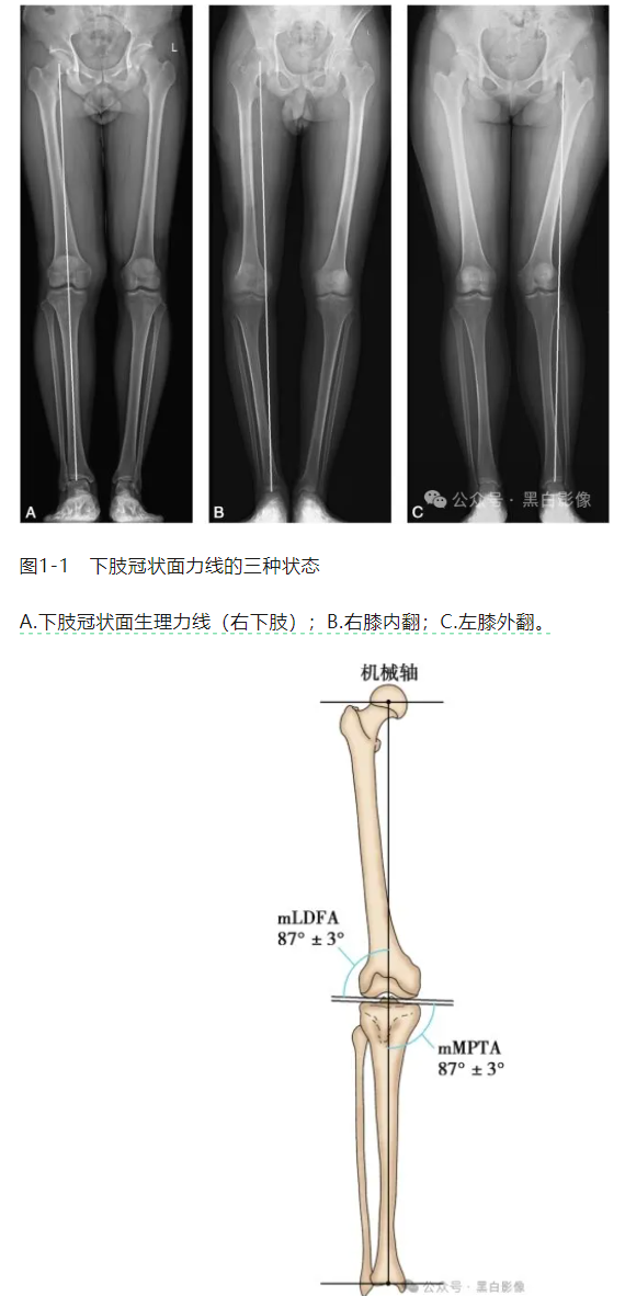 下肢生理力线及其临床意义