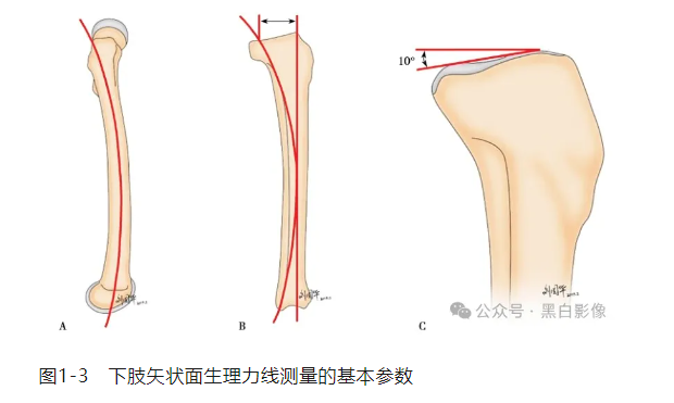 下肢生理力线及其临床意义