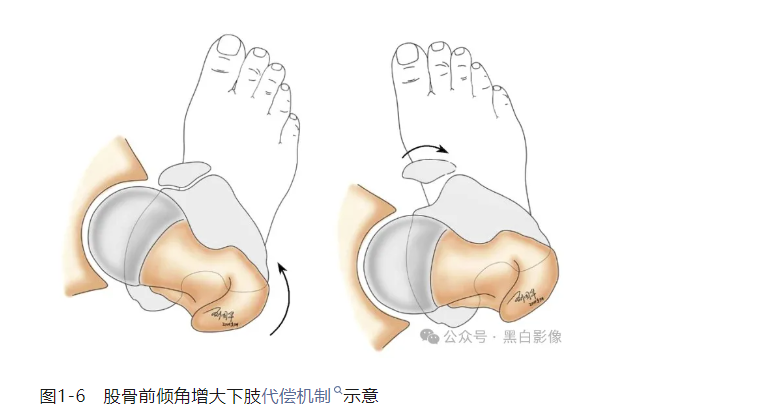 下肢生理力线及其临床意义